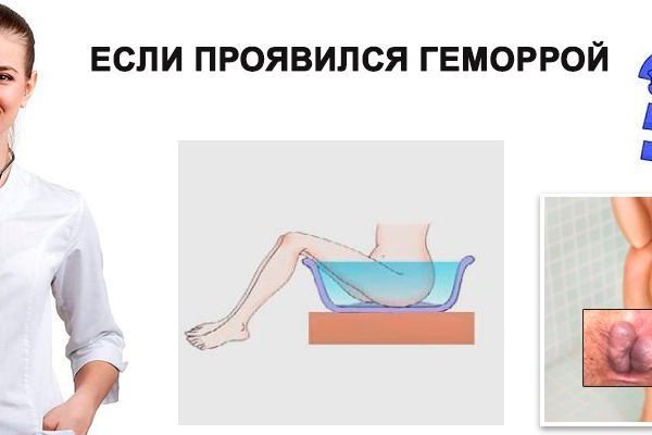 Кракен официальная ссылка kraken torion
